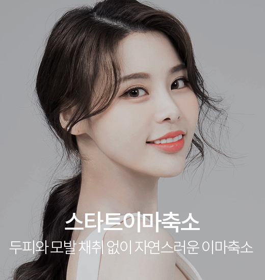 스타트 이마축소
